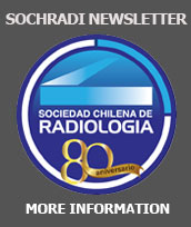 SOCHARDI